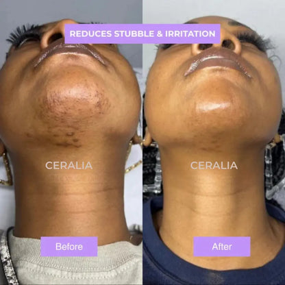 Ceralia™ | Cyperus Rotundus Hair Growth Reduction Serum